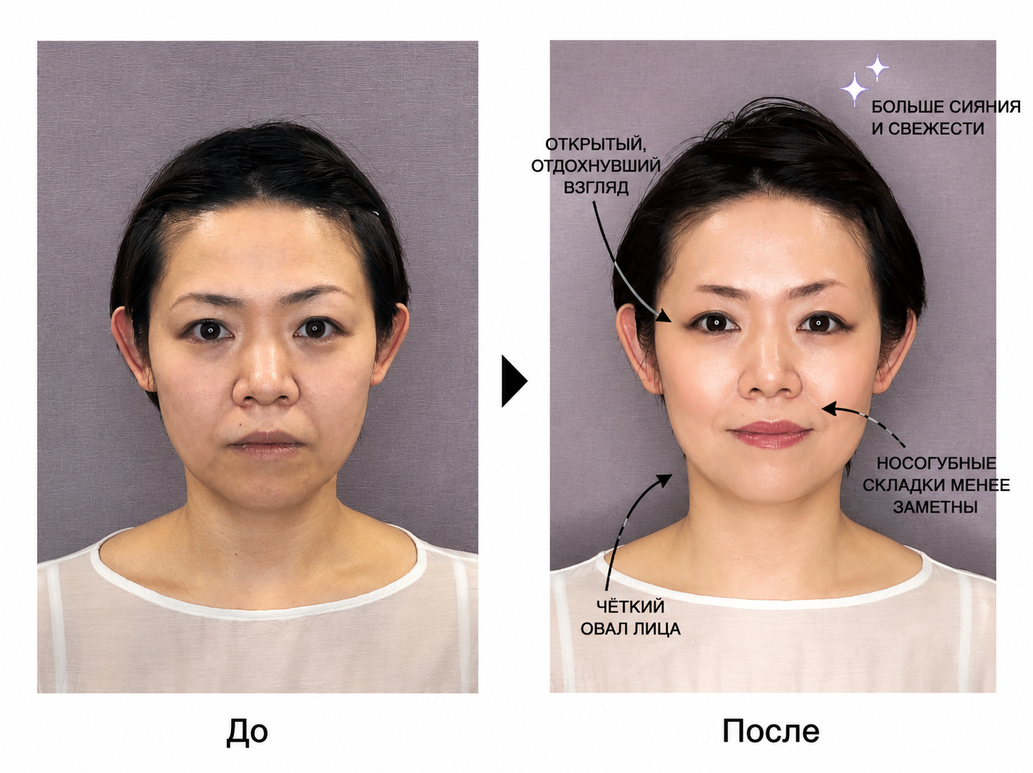 Лифтинг-кушон с защитой от солнца SPF40/PA+++ Dr. Soie